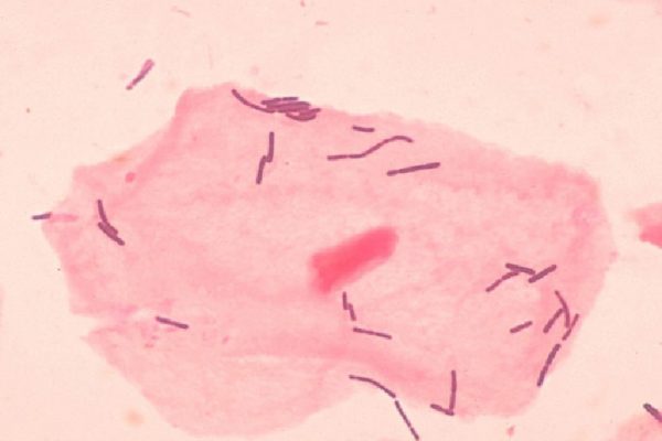 Lactobacillus Acidophilus